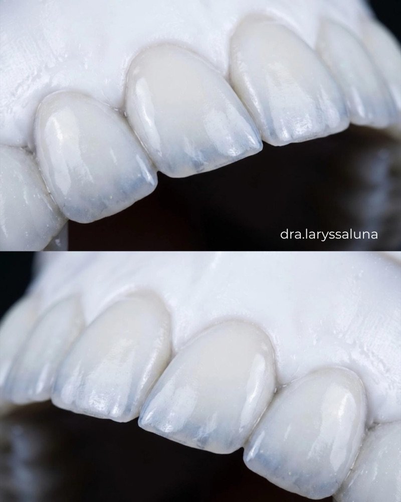Detalhe da translucidez das lentes de resina